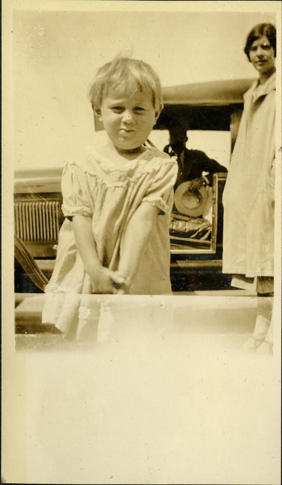 Dean and the mumps 1926 - child with mumps, swollen face