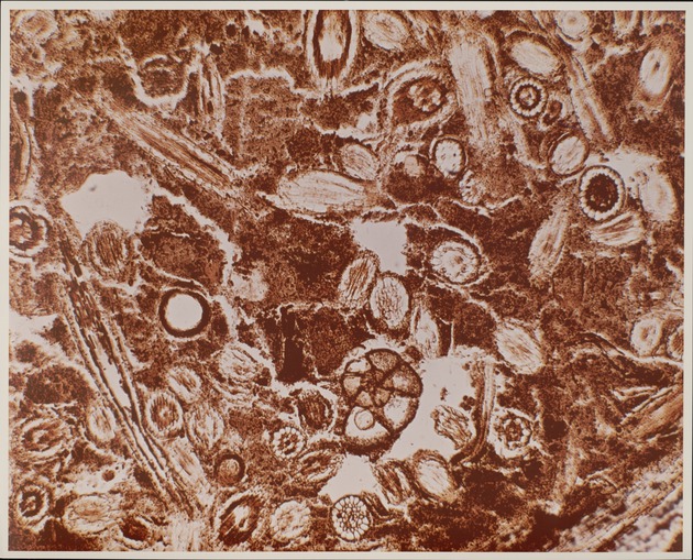 Microscopic View of Rhizophora Root Peat - recto
